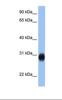 RAB3D Antibody - Transfected 293T cell lysate. Antibody concentration: 2.5 ug/ml. Gel concentration: 12%.  This image was taken for the unconjugated form of this product. Other forms have not been tested.