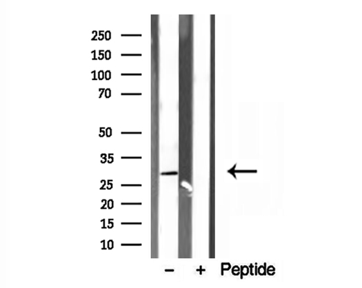 RAB3D Antibody - Western blot analysis of extracts of A549 cells using RAB3D antibody.