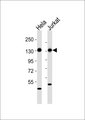 RAB3GAP1 Antibody - All lanes : Anti-RAB3GAP1 Antibody at 1:1000 dilution Lane 1: HeLa whole cell lysates Lane 2: Jurkat whole cell lysates Lysates/proteins at 20 ug per lane. Secondary Goat Anti-Rabbit IgG, (H+L),Peroxidase conjugated at 1/10000 dilution Predicted band size : 111 kDa Blocking/Dilution buffer: 5% NFDM/TBST.
