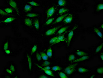 RAB3GAP1 Antibody - Immunofluorescence staining of Hela cells at a dilution of 1:100, counter-stained with DAPI. The cells were fixed in 4% formaldehyde, permeabilized using 0.2% Triton X-100 and blocked in 10% normal Goat Serum. The cells were then incubated with the antibody overnight at 4 °C.The secondary antibody was Alexa Fluor 488-congugated AffiniPure Goat Anti-Rabbit IgG (H+L) .