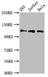 RAB3GAP1 Antibody - Western Blot Positive WB detected in: 293 whole cell lysate, Jurkat whole cell lysate, Hela whole cell lysate All lanes: RAB3GAP1 antibody at 7µg/ml Secondary Goat polyclonal to rabbit IgG at 1/50000 dilution Predicted band size: 111, 112, 106 kDa Observed band size: 111 kDa