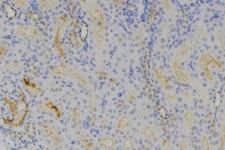 RAB3GAP1 Antibody - 1:100 staining human lymph node tissue by IHC-P. The sample was formaldehyde fixed and a heat mediated antigen retrieval step in citrate buffer was performed. The sample was then blocked and incubated with the antibody for 1.5 hours at 22°C. An HRP conjugated goat anti-rabbit antibody was used as the secondary.