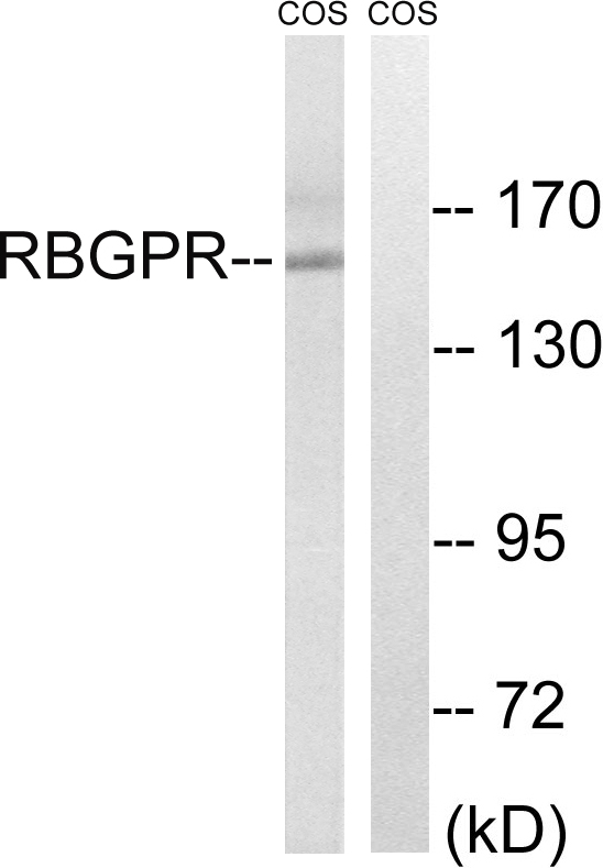 RAB3GAP2 / p150 Antibody - Western blot analysis of lysates from COS cells, using RAB3GAP2 Antibody. The lane on the right is blocked with the synthesized peptide.