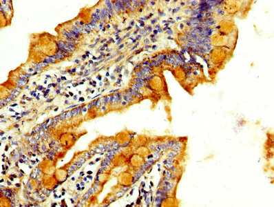 RAB3GAP2 / p150 Antibody - Immunohistochemistry image at a dilution of 1:300 and staining in paraffin-embedded human small intestine tissue performed on a Leica BondTM system. After dewaxing and hydration, antigen retrieval was mediated by high pressure in a citrate buffer (pH 6.0) . Section was blocked with 10% normal goat serum 30min at RT. Then primary antibody (1% BSA) was incubated at 4 °C overnight. The primary is detected by a biotinylated secondary antibody and visualized using an HRP conjugated SP system.