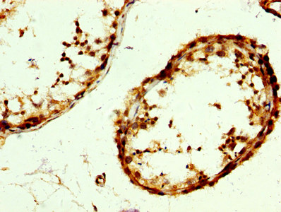 RAB3GAP2 / p150 Antibody - Immunohistochemistry image at a dilution of 1:300 and staining in paraffin-embedded human testis tissue performed on a Leica BondTM system. After dewaxing and hydration, antigen retrieval was mediated by high pressure in a citrate buffer (pH 6.0) . Section was blocked with 10% normal goat serum 30min at RT. Then primary antibody (1% BSA) was incubated at 4 °C overnight. The primary is detected by a biotinylated secondary antibody and visualized using an HRP conjugated SP system.