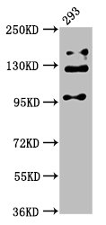 RAB3GAP2 / p150 Antibody - Positive Western Blot detected in 293 whole cell lysate. All lanes: RAB3GAP2 antibody at 5 µg/ml Secondary Goat polyclonal to rabbit IgG at 1/50000 dilution. Predicted band size: 156, 24 KDa. Observed band size: 110, 130, 150 KDa