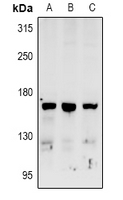 RAB3GAP2 / p150 Antibody - Western blot analysis of RAB3GAP2 expression in MCF7 (A), SGC7901 (B), A549 (C) whole cell lysates.