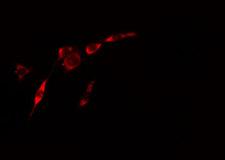 RAB3GAP2 / p150 Antibody - Staining HeLa cells by IF/ICC. The samples were fixed with PFA and permeabilized in 0.1% Triton X-100, then blocked in 10% serum for 45 min at 25°C. The primary antibody was diluted at 1:200 and incubated with the sample for 1 hour at 37°C. An Alexa Fluor 594 conjugated goat anti-rabbit IgG (H+L) antibody, diluted at 1/600, was used as secondary antibody.