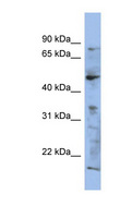 RAB3IP / RABIN3 Antibody - RAB3IP antibody Western blot of NCI-H226 cell lysate. This image was taken for the unconjugated form of this product. Other forms have not been tested.