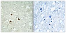 RAB3IP / RABIN3 Antibody - Immunohistochemistry analysis of paraffin-embedded human brain tissue, using RAB3IP Antibody. The picture on the right is blocked with the synthesized peptide.