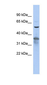 RAB3IP / RABIN3 Antibody - RAB3IP antibody Western blot of 293T cell lysate. This image was taken for the unconjugated form of this product. Other forms have not been tested.