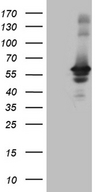 RAB3IP / RABIN3 Antibody - HEK293T cells were transfected with the pCMV6-ENTRY control. (Left lane) or pCMV6-ENTRY RAB3IP. (Right lane) cDNA for 48 hrs and lysed. Equivalent amounts of cell lysates. (5 ug per lane) were separated by SDS-PAGE and immunoblotted with anti-RAB3IP. (1:2000)