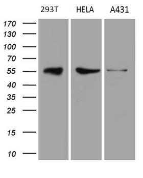 RAB3IP / RABIN3 Antibody - Western blot analysis of extracts. (35ug) from 3 different cell lines by using anti-RAB3IP monoclonal antibody. (HeLa: human; 293T: human;A431: human). (1:500)
