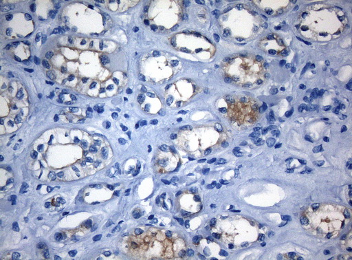 RAB3IP / RABIN3 Antibody - Immunohistochemical staining of paraffin-embedded Human Kidney tissue within the normal limits using anti-RAB3IP mouse monoclonal antibody. (Heat-induced epitope retrieval by 1mM EDTA in 10mM Tris buffer. (pH8.5) at 120°C for 3 min. (1:150)