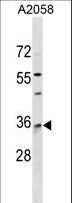 RAB40A / RAR2 Antibody - RAB40A Antibody western blot of A2058 cell line lysates (35 ug/lane). The RAB40A antibody detected the RAB40A protein (arrow).