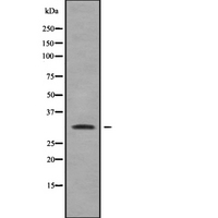 RAB40A / RAR2 Antibody - Western blot analysis of RAB40A using Jurkat whole cells lysates