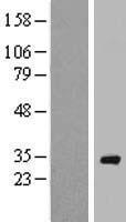 RAB40A / RAR2 Protein - Western validation with an anti-DDK antibody * L: Control HEK293 lysate R: Over-expression lysate
