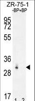 RAB40AL Antibody - Western blot of RAB40AL Antibody antibody pre-incubated without(lane 1) and with(lane 2) blocking peptide in ZR-75-1 cell line lysate. RAB40AL Antibody (arrow) was detected using the purified antibody.
