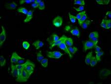 RAB40AL Antibody - Immunofluorescence staining of MCF-7 cells diluted at 1:33, counter-stained with DAPI. The cells were fixed in 4% formaldehyde, permeabilized using 0.2% Triton X-100 and blocked in 10% normal Goat Serum. The cells were then incubated with the antibody overnight at 4°C.The Secondary antibody was Alexa Fluor 488-congugated AffiniPure Goat Anti-Rabbit IgG (H+L).