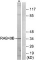 RAB40B Antibody - Western blot analysis of lysates from Jurkat cells, using RAB40B Antibody. The lane on the right is blocked with the synthesized peptide.