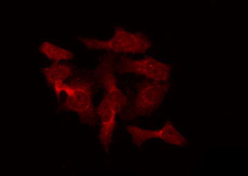 RAB40B Antibody - Staining HeLa cells by IF/ICC. The samples were fixed with PFA and permeabilized in 0.1% Triton X-100, then blocked in 10% serum for 45 min at 25°C. The primary antibody was diluted at 1:200 and incubated with the sample for 1 hour at 37°C. An Alexa Fluor 594 conjugated goat anti-rabbit IgG (H+L) Ab, diluted at 1/600, was used as the secondary antibody.