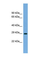 RAB40C Antibody - RAB40C antibody Western blot of Fetal Muscle lysate. This image was taken for the unconjugated form of this product. Other forms have not been tested.