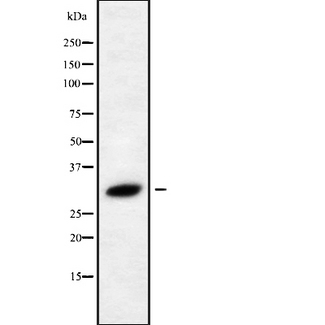 RAB40C Antibody - Western blot analysis of RAB40C using HeLa whole cells lysates