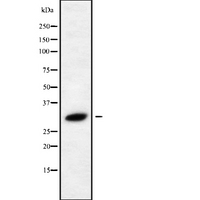 RAB40C Antibody - Western blot analysis of RAB40C using HeLa whole cells lysates