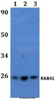 RAB41 Antibody - Western blot of RAB41 antibody at 1:500 dilution. Lane 1: HEK293T whole cell lysate. Lane 2: Raw264.7 whole cell lysate. Lane 3: H9C2 whole cell lysate.