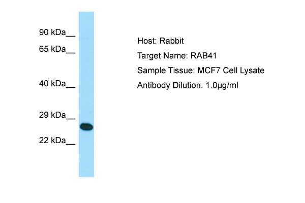 RAB41 Antibody -  This image was taken for the unconjugated form of this product. Other forms have not been tested.