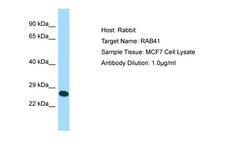 RAB41 Antibody -  This image was taken for the unconjugated form of this product. Other forms have not been tested.