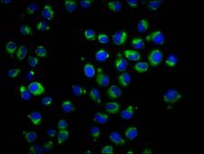RAB42 Antibody - Immunofluorescence staining of Hela cells diluted at 1:166, counter-stained with DAPI. The cells were fixed in 4% formaldehyde, permeabilized using 0.2% Triton X-100 and blocked in 10% normal Goat Serum. The cells were then incubated with the antibody overnight at 4°C.The Secondary antibody was Alexa Fluor 488-congugated AffiniPure Goat Anti-Rabbit IgG (H+L).