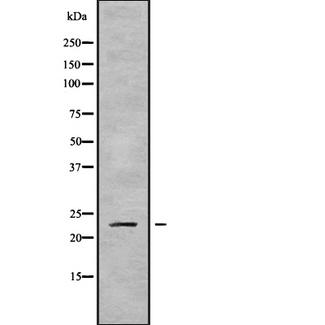 RAB43 Antibody - Western blot analysis of RAB43 using K562 whole cells lysates