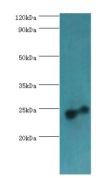 RAB4A / RAB4 Antibody - Western blot. All lanes: Ras-related protein Rab-4A antibody at 2 ug/ml+mouse brain tissue. Secondary antibody: Goat polyclonal to rabbit at 1:10000 dilution. Predicted band size: 24 kDa. Observed band size: 24 kDa Immunohistochemistry.