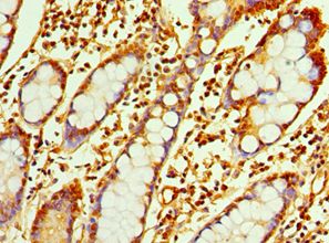 RAB4A / RAB4 Antibody - Immunohistochemistry of paraffin-embedded human small intestine using antibody at 1:100 dilution.