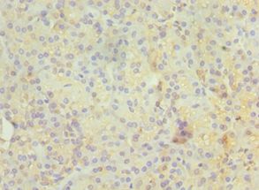 RAB4A / RAB4 Antibody - Immunohistochemistry of paraffin-embedded human pancreas using antibody at 1:100 dilution.