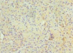 RAB4A / RAB4 Antibody - Immunohistochemistry of paraffin-embedded human pancreatic tissue using RAB4A Antibody at dilution of 1:100