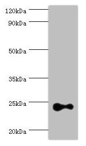 RAB4A / RAB4 Antibody - Western blot All lanes: Ras-related protein Rab-4A antibody at 2µg/ml + Mouse brain tissue Secondary Goat polyclonal to rabbit IgG at 1/10000 dilution Predicted band size: 24 kDa Observed band size: 24 kDa