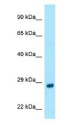 RAB4A / RAB4 Antibody - RAB4A / RAB4 antibody Western Blot of Fetal Stomach.  This image was taken for the unconjugated form of this product. Other forms have not been tested.