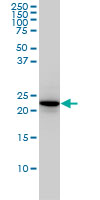 RAB4A / RAB4 Antibody - RAB4A monoclonal antibody (M01), clone 1C10 Western Blot analysis of RAB4A expression in HeLa.