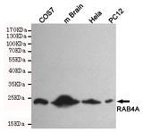 RAB4A / RAB4 Antibody - Western blot detection of RAB4A in HeLa, PC-12, COS7 and mouse brain cell lysates using RAB4A mouse monoclonal antibody (1:500 dilution). Predicted band size: 24KDa. Observed band size:24KDa.