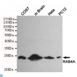 RAB4A / RAB4 Antibody - Western blot detection of RAB4A in Hela, PC-12, COS7 and mouse brain cell lysates using RAB4A mouse mAb (1:500 diluted). Predicted band size: 24KDa. Observed band size: 24KDa.