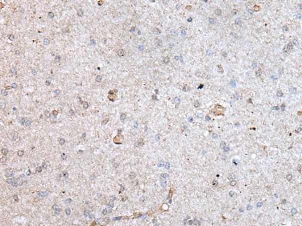 RAB4A / RAB4 Antibody - Immunohistochemistry of paraffin-embedded Human brain tissue  using RAB4A Polyclonal Antibody at dilution of 1:40(×200)
