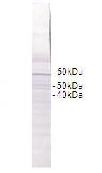 RAB4B Antibody - RAB4B antibody Western Blot of Brugia malayi nematode.  This image was taken for the unconjugated form of this product. Other forms have not been tested.