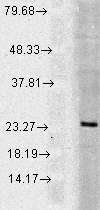 RAB5 Antibody - Western blot analysis of Rab5 in a human cell line mix using a 1:1000 dilution of RAB5 antibody.  This image was taken for the unconjugated form of this product. Other forms have not been tested.