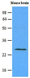 RAB5A / RAB5 Antibody - The extracts of mouse brain (45 ug) were resolved by SDS-PAGE, transferred to NC membrane and probed with anti-human Rab5a (1:500). Proteins were visualized using a goat anti-mouse secondary antibody conjugated to HRP and an ECL detection system.