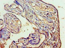 RAB5A / RAB5 Antibody - Immunohistochemistry of paraffin-embedded human placenta tissue using antibody at 1:100 dilution.  This image was taken for the unconjugated form of this product. Other forms have not been tested.