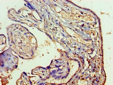 RAB5A / RAB5 Antibody - Immunohistochemistry of paraffin-embedded human placenta tissue using RAB5A Antibody at dilution of 1:100