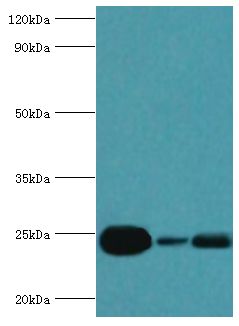 RAB5A / RAB5 Antibody - Western blot. All lanes: Ras-related protein Rab-5A antibody at 5 ug/ml. Lane 1: mouse brain tissue. Lane 2: HL-60 whole cell lysate. Lane 3: HeLa whole cell lysate. Secondary antibody: Goat polyclonal to rabbit at 1:10000 dilution. Predicted band size: 24 kDa. Observed band size: 24 kDa.