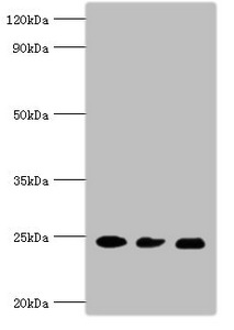RAB5A / RAB5 Antibody - Western blot All lanes: Ras-related protein Rab-5A antibody at 5µg/ml Lane 1: Mouse brain tissue Lane 2: HL60 whole cell lysate Lane 3: Hela whole cell lysate Secondary Goat polyclonal to rabbit IgG at 1/10000 dilution Predicted band size: 24, 23 kDa Observed band size: 24 kDa